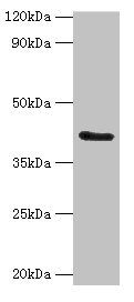 FUT6 Antibody - Western blot All lanes: FUT6 antibody at 4µg/ml + Hela whole cell lysate Secondary Goat polyclonal to rabbit IgG at 1/10000 dilution Predicted band size: 42, 43 kDa Observed band size: 42 kDa