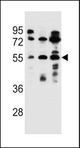 FUT6 Antibody - FUT6 Antibody western blot of ZR-75-1,NCI-H292,293 cell line lysates (35 ug/lane). The FUT6 antibody detected the FUT6 protein (arrow).