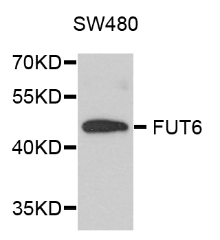 FUT6 Antibody - Western blot analysis of extract of various cells.