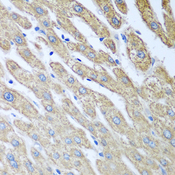FUT6 Antibody - Immunohistochemistry of paraffin-embedded human liver tissue.