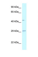 FUT8 Antibody - FUT8 antibody Western blot of Fetal Liver lysate. Antibody concentration 1 ug/ml.  This image was taken for the unconjugated form of this product. Other forms have not been tested.
