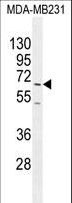 FUT8 Antibody - FUT8 Antibody western blot of MDA-MB231 cell line lysates (35 ug/lane). The FUT8 antibody detected the FUT8 protein (arrow).