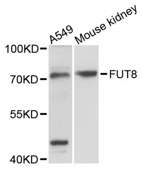 FUT8 Antibody - Western blot analysis of extracts of various cell lines, using FUT8 antibody at 1:3000 dilution. The secondary antibody used was an HRP Goat Anti-Rabbit IgG (H+L) at 1:10000 dilution. Lysates were loaded 25ug per lane and 3% nonfat dry milk in TBST was used for blocking. An ECL Kit was used for detection and the exposure time was 90s.