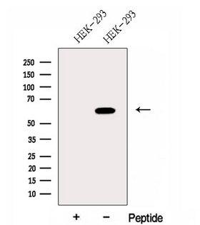 FUT8 Antibody - Western blot analysis of extracts of HEK293 cells using FUT8 antibody. The lane on the left was treated with blocking peptide.
