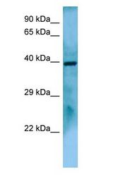 FUZ / FY Antibody - FUZ / FY antibody Western Blot of COLO205 cell lysate.  This image was taken for the unconjugated form of this product. Other forms have not been tested.