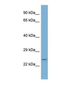 FVT1 / KDSR Antibody - Western blot of Human PANC1 Whole cell . KDSR antibody dilution 1.0 ug/ml.  This image was taken for the unconjugated form of this product. Other forms have not been tested.