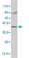 FVT1 / KDSR Antibody - FVT1 monoclonal antibody (M01), clone 2B2-3C11 Western Blot analysis of FVT1 expression in Jurkat.