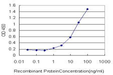 FVT1 / KDSR Antibody - Detection limit for recombinant GST tagged FVT1 is approximately 1 ng/ml as a capture antibody.