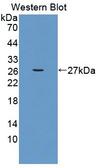 FVT1 / KDSR Antibody - Western Blot; Sample: Recombinant protein.