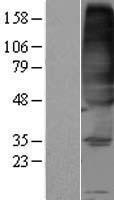 FVT1 / KDSR Protein - Western validation with an anti-DDK antibody * L: Control HEK293 lysate R: Over-expression lysate