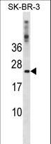 FXN / Frataxin Antibody - FXN Antibody western blot of SK-BR-3 cell line lysates (35 ug/lane). The FXN antibody detected the FXN protein (arrow).