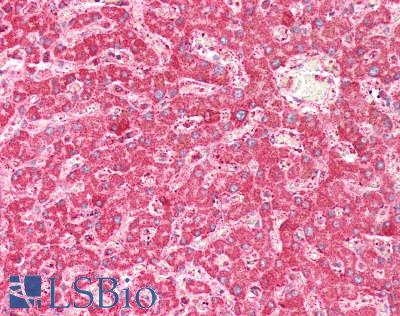 FXN / Frataxin Antibody - Human Liver: Formalin-Fixed, Paraffin-Embedded (FFPE)