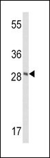 FXN / Frataxin Antibody - Western blot of FXN Antibody in CEM cell line lysates (35 ug/lane). FXN (arrow) was detected using the purified antibody.