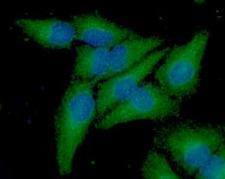 FXN / Frataxin Antibody - ICC/IF analysis of Frataxin in A549 cell line, stained with DAPI (Blue) for nucleus staining and monoclonal anti-human Frataxin antibody (1:100) with goat anti-mouse IgG-Alexa fluor 488 conjugate (Green).