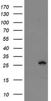 FXN / Frataxin Antibody - HEK293T cells were transfected with the pCMV6-ENTRY control (Left lane) or pCMV6-ENTRY FXN (Right lane) cDNA for 48 hrs and lysed. Equivalent amounts of cell lysates (5 ug per lane) were separated by SDS-PAGE and immunoblotted with anti-FXN.