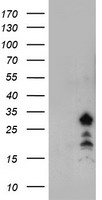 FXN / Frataxin Antibody - HEK293T cells were transfected with the pCMV6-ENTRY control (Left lane) or pCMV6-ENTRY FXN (Right lane) cDNA for 48 hrs and lysed. Equivalent amounts of cell lysates (5 ug per lane) were separated by SDS-PAGE and immunoblotted with anti-FXN.