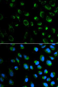 FXN / Frataxin Antibody - Immunofluorescence analysis of MCF7 cell using FXN antibody. Blue: DAPI for nuclear staining.