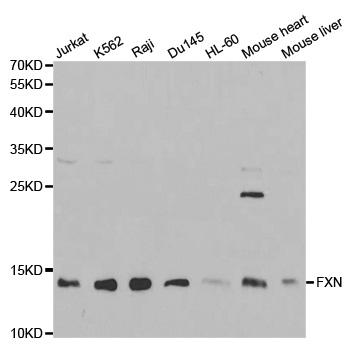 FXN / Frataxin Antibody - Western blot analysis of extracts of various cell lines, using FXN antibody at 1:1000 dilution. The secondary antibody used was an HRP Goat Anti-Rabbit IgG (H+L) at 1:10000 dilution. Lysates were loaded 25ug per lane and 3% nonfat dry milk in TBST was used for blocking.