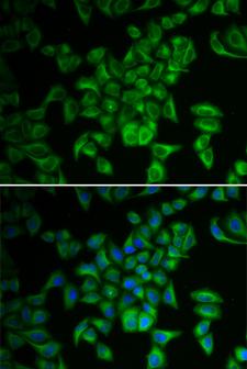 FXN / Frataxin Antibody - Immunofluorescence analysis of A549 cells using FXN antibody. Blue: DAPI for nuclear staining.