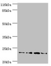 FXN / Frataxin Antibody - Western blot All lanes: FXN antibody at 2µg/ml Lane 1: HepG2 whole cell lysate Lane 2: Hela whole cell lysate Lane 3: Mouse brain tissue Lane4: Jurkat whole cell lysate Secondary Goat polyclonal to rabbit IgG at 1/10000 dilution Predicted band size: 23 kDa Observed band size: 23 kDa