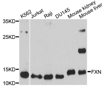FXN / Frataxin Antibody - Western blot analysis of extracts of various cell lines, using FXN antibody at 1:1000 dilution. The secondary antibody used was an HRP Goat Anti-Rabbit IgG (H+L) at 1:10000 dilution. Lysates were loaded 25ug per lane and 3% nonfat dry milk in TBST was used for blocking. An ECL Kit was used for detection and the exposure time was 10s.