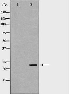 FXN / Frataxin Antibody - Western blot analysis of A549 whole cells lysates using FXN antibody. The lane on the left is treated with the antigen-specific peptide.