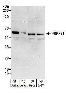 FXR1 Antibody - Detection of human PRPF31 by western blot. Samples: Whole cell lysate from Jurkat (15 and 50 µg), HeLa (50µg), and HEK293T (50µg) cells. Antibodies: Affinity purified rabbit anti-PRPF31 antibody used for WB at 0.1 µg/ml. Detection: Chemiluminescence with an exposure time of 3 minutes.