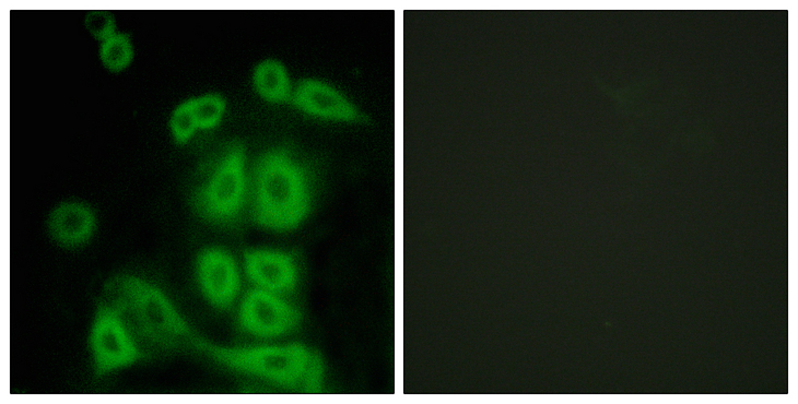 FXR2 Antibody - Immunofluorescence analysis of A549 cells, using FXR2 Antibody. The picture on the right is blocked with the synthesized peptide.