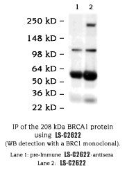 FXR2 Antibody -  This image was taken for the unconjugated form of this product. Other forms have not been tested.
