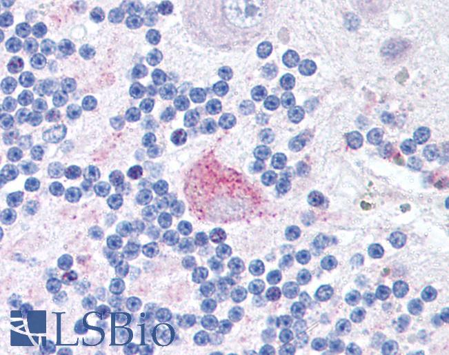 FXR2 Antibody - Anti-FXR2 antibody IHC of human brain, cerebellum. Immunohistochemistry of formalin-fixed, paraffin-embedded tissue after heat-induced antigen retrieval. Antibody concentration 20 ug/ml.  This image was taken for the unconjugated form of this product. Other forms have not been tested.