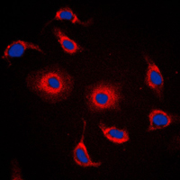 FXR2 Antibody - Immunofluorescent analysis of FXR2 staining in HepG2 cells. Formalin-fixed cells were permeabilized with 0.1% Triton X-100 in TBS for 5-10 minutes and blocked with 3% BSA-PBS for 30 minutes at room temperature. Cells were probed with the primary antibody in 3% BSA-PBS and incubated overnight at 4 C in a humidified chamber. Cells were washed with PBST and incubated with a DyLight 594-conjugated secondary antibody (red) in PBS at room temperature in the dark. DAPI was used to stain the cell nuclei (blue).