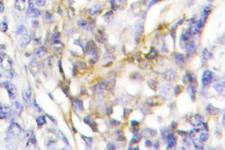 FXR2 Antibody - IHC of FXR2 (E576) pAb in paraffin-embedded human muscle tissue.