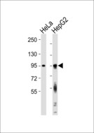 FXR2 Antibody - All lanes : Anti-FXR2 Antibody at 1:1000 dilution Lane 1: HeLa whole cell lysates Lane 2: HepG2 whole cell lysates Lysates/proteins at 20 ug per lane. Secondary Goat Anti-Rabbit IgG, (H+L),Peroxidase conjugated at 1/10000 dilution Predicted band size : 75 kDa Blocking/Dilution buffer: 5% NFDM/TBST.