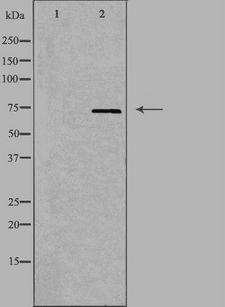 FXR2 Antibody - Western blot analysis of extracts of COLO205 cells using FXR2 antibody. The lane on the left is treated with the antigen-specific peptide.