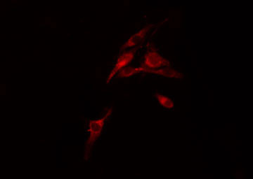 FXR2 Antibody - Staining COLO205 cells by IF/ICC. The samples were fixed with PFA and permeabilized in 0.1% Triton X-100, then blocked in 10% serum for 45 min at 25°C. The primary antibody was diluted at 1:200 and incubated with the sample for 1 hour at 37°C. An Alexa Fluor 594 conjugated goat anti-rabbit IgG (H+L) antibody, diluted at 1/600, was used as secondary antibody.