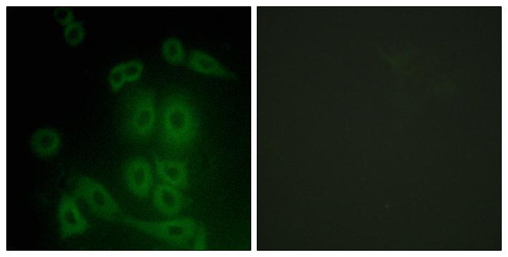 FXR2 Antibody - Peptide - + Immunofluorescence analysis of A549 cells, using FXR2 antibody.