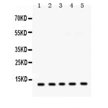 FXYD1 / Phospholemman Antibody - FXYZ1 antibody Western blot. All lanes: Anti FXYZ1 at 0.5 ug/ml. Lane 1: Rat Liver Tissue Lysate at 50 ug. Lane 2: Rat Cardiac Muscle Tissue Lysate at 50 ug. Lane 3: Mouse Cardiac Muscle Tissue Lysate at 50 ug. Lane 4: HEPG2 Whole Cell Lysate at 40 ug. Lane 5: HELA Whole Cell Lysate at 40 ug. Predicted band size: 10 kD. Observed band size: 10 kD.