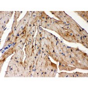 FXYD1 / Phospholemman Antibody - FXYZ1 antibody IHC-paraffin. IHC(P): Mouse Cardiac Muscle Tissue.