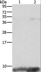 FXYD1 / Phospholemman Antibody - Western blot analysis of Mouse brain and heart tissue, using FXYD1 Polyclonal Antibody at dilution of 1:1290.