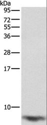 FXYD1 / Phospholemman Antibody - Western blot analysis of Mouse heart tissue, using FXYD1 Polyclonal Antibody at dilution of 1:1290.