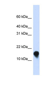 FXYD1 / Phospholemman Antibody - FXYD1 antibody Western blot of Transfected 293T cell lysate. This image was taken for the unconjugated form of this product. Other forms have not been tested.