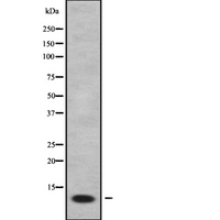FXYD2 Antibody - Western blot analysis FXYD2 using COLO205 whole cells lysates