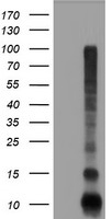 FXYD3 Antibody - HEK293T cells were transfected with the pCMV6-ENTRY control (Left lane) or pCMV6-ENTRY FXYD3 (Right lane) cDNA for 48 hrs and lysed. Equivalent amounts of cell lysates (5 ug per lane) were separated by SDS-PAGE and immunoblotted with anti-FXYD3.