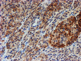 FXYD3 Antibody - IHC of paraffin-embedded Human pancreas tissue using anti-FXYD3 mouse monoclonal antibody. (Heat-induced epitope retrieval by 10mM citric buffer, pH6.0, 100C for 10min).