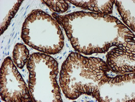FXYD3 Antibody - IHC of paraffin-embedded Human prostate tissue using anti-FXYD3 mouse monoclonal antibody. (Heat-induced epitope retrieval by 10mM citric buffer, pH6.0, 100C for 10min).