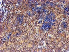 FXYD3 Antibody - IHC of paraffin-embedded Human lymphoma tissue using anti-FXYD3 mouse monoclonal antibody. (Heat-induced epitope retrieval by 10mM citric buffer, pH6.0, 100C for 10min).
