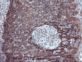FXYD3 Antibody - IHC of paraffin-embedded Human tonsil using anti-FXYD3 mouse monoclonal antibody. (Heat-induced epitope retrieval by 10mM citric buffer, pH6.0, 100C for 10min).