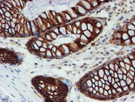 FXYD3 Antibody - IHC of paraffin-embedded Human colon tissue using anti-FXYD3 mouse monoclonal antibody. (Heat-induced epitope retrieval by 10mM citric buffer, pH6.0, 100C for 10min).