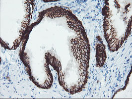 FXYD3 Antibody - IHC of paraffin-embedded Human prostate tissue using anti-FXYD3 mouse monoclonal antibody.