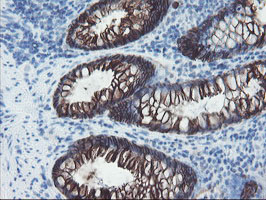 FXYD3 Antibody - IHC of paraffin-embedded Human colon tissue using anti-FXYD3 mouse monoclonal antibody.
